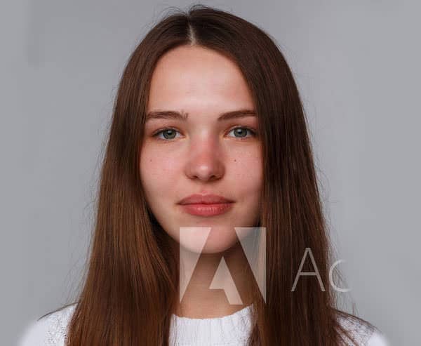 Skin before using the skincare kit